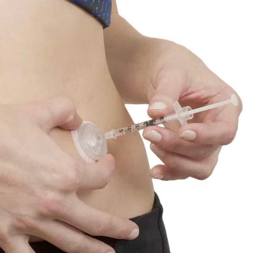I-Port Advance 6 mm Subkutan Injeksjonsport 10 stk